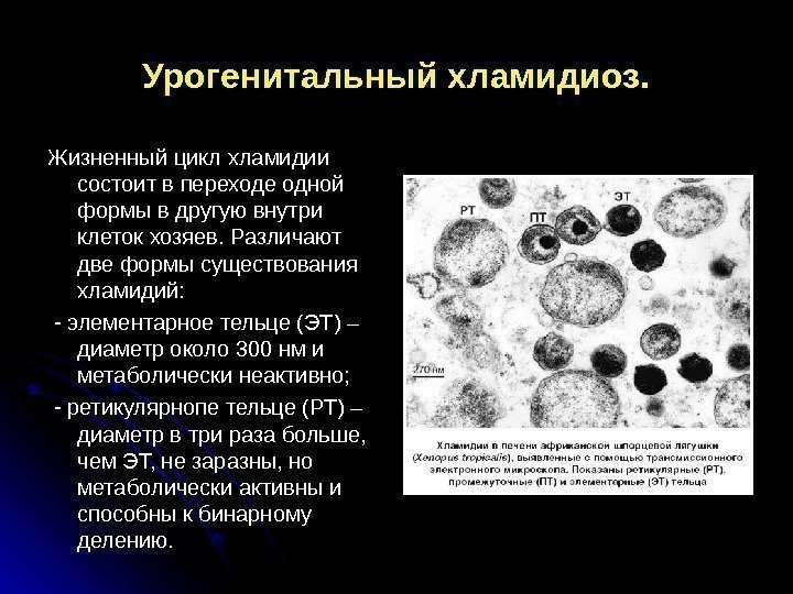 Урогенитальный хламидиоз. Жизненный цикл хламидии состоит в переходе одной формы в другую внутри клеток