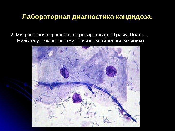 Лабораторная диагностика кандидоза. 2. Микроскопия окрашенных препаратов ( по Граму, Цилю – Нильсену, Романовскому