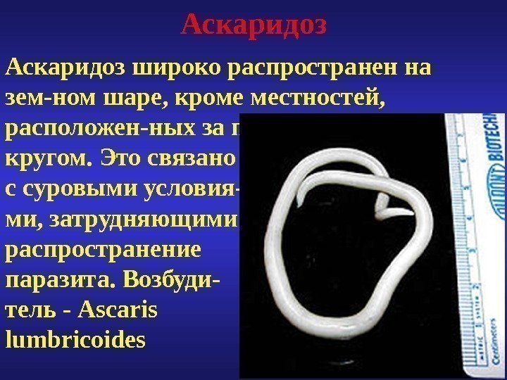 Какие продукты источник аскаридоза. Аскаридоз клинические проявления.