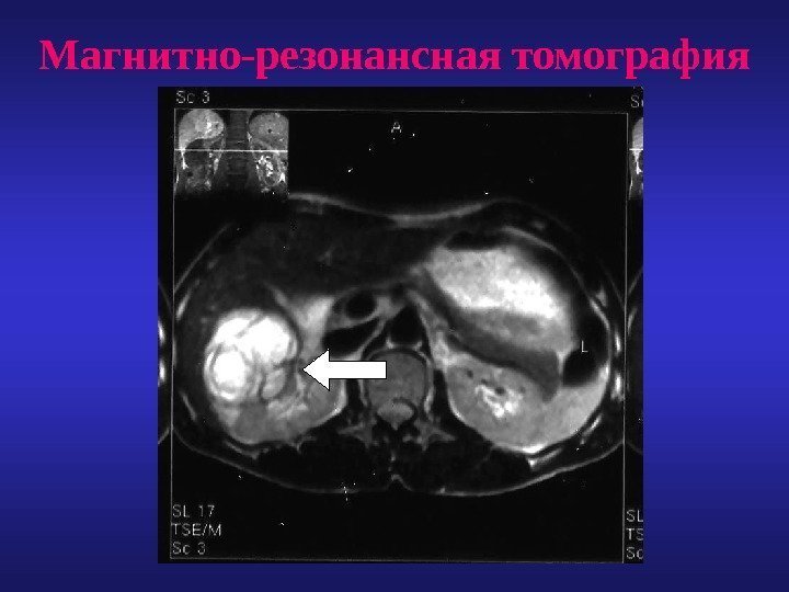 Магнитно-резонансная томография 