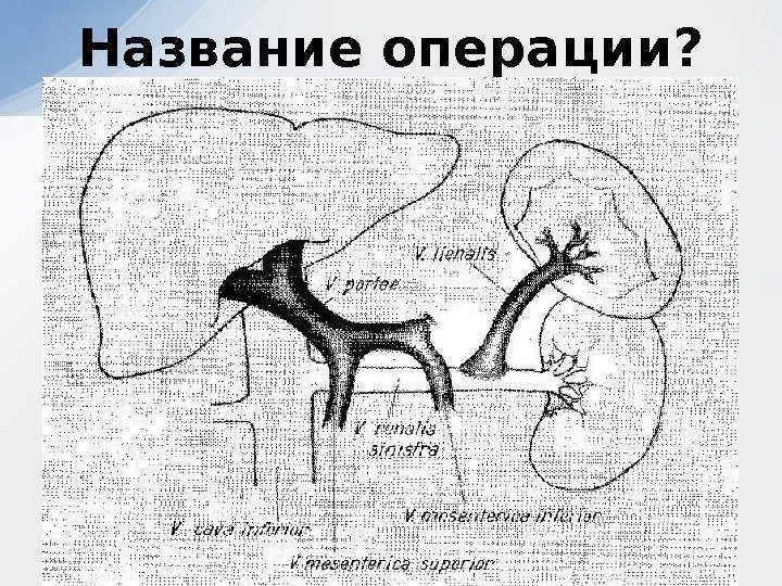 Название операции? 