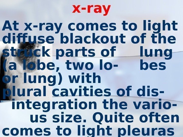 x-ray At x-ray comes to light diffuse blackout of the struck parts of lung