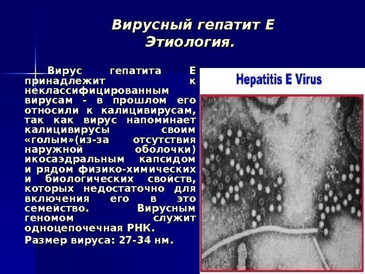   Вирусный гепатит Е Этиология.  Вирус гепатита Е принадлежит к неклассифицированным вирусам