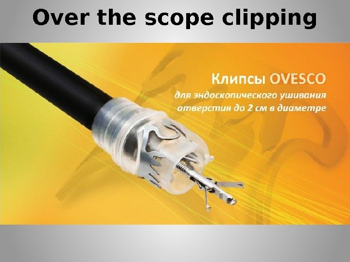 Over the scope clipping 