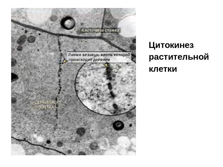 Цитокинез растительной клетки 