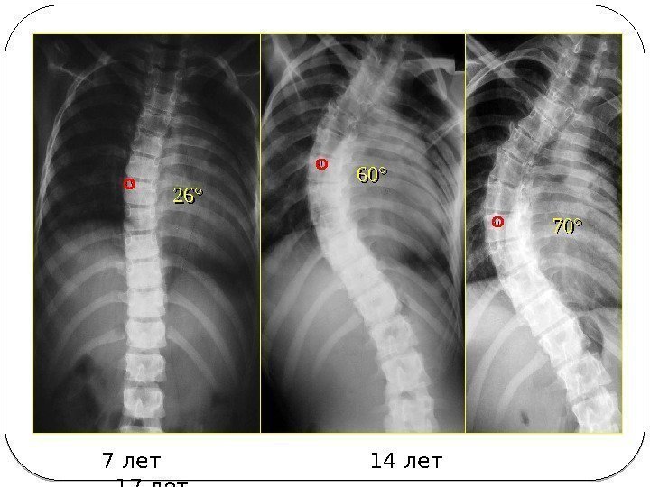 26° 60° 70° 7 лет     14 лет   