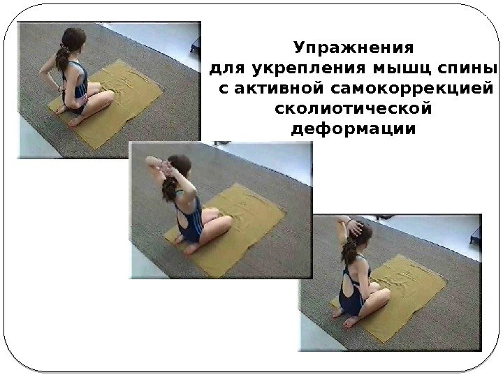 Упражнения для укрепления мышц спины с активной самокоррекцией сколиотической деформации 