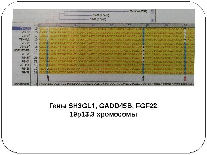 Гены SH 3 GL 1, GADD 45 B, FGF 22 19 p 13. 3