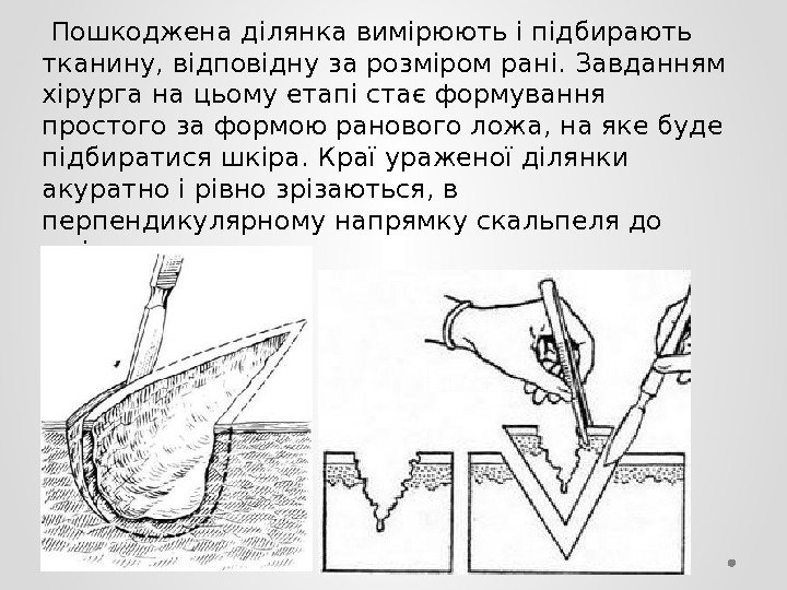  Пошкоджена ділянка вимірюють і підбирають тканину, відповідну за розміром рані. Завданням хірурга на