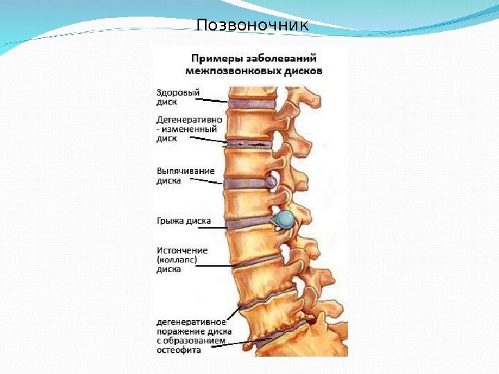  Позвоночник 