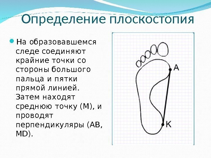  На образовавшемся следе соединяют крайние точки со стороны большого пальца и пятки прямой