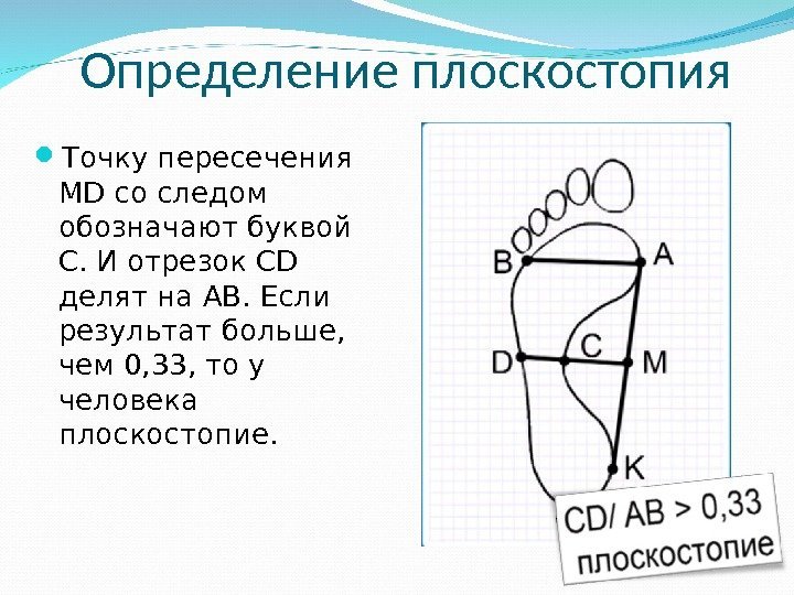  Точку пересечения MD со следом обозначают буквой С. И отрезок CD делят на