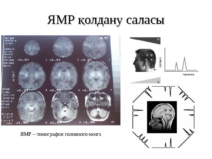 ЯМР олдану саласық ЯМР – томография головного мозга 