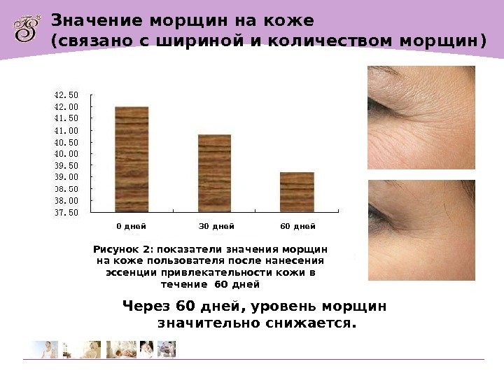 Значение морщин на коже ( связано с шириной и количеством морщин ) Через 60