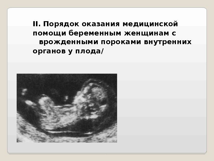 II. Порядок оказания медицинской помощи беременным женщинам с врожденными пороками внутренних органов у плода