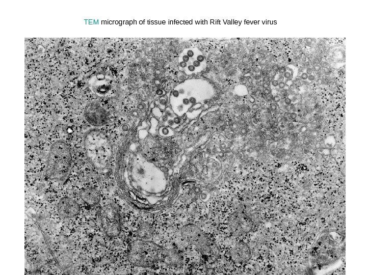   TEM micrograph of tissue infected with Rift Valley fever virus  