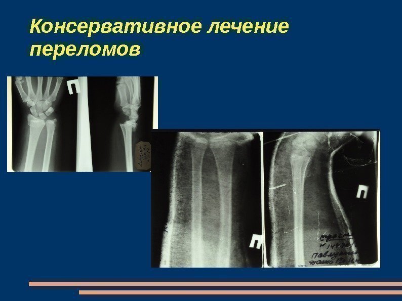 Повреждение кисти травматология презентация