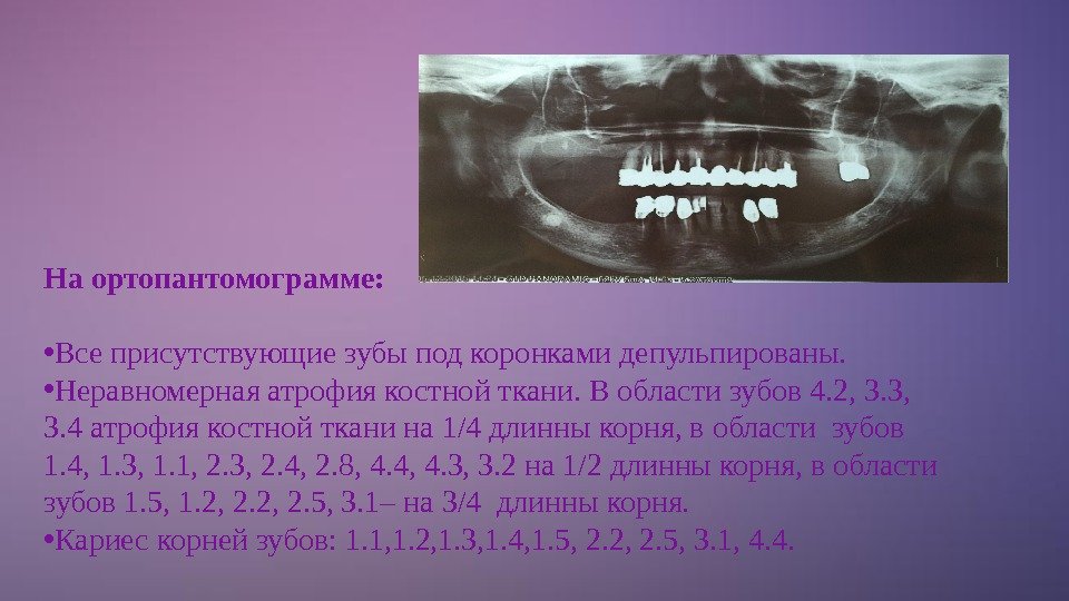 Схема описания ортопантомограммы