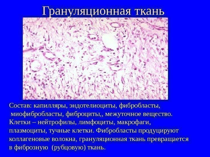   Грануляционная ткань Состав: капилляры, эндотелиоциты, фибробласты,  миофибробласты, фиброциты, , межуточное вещество.