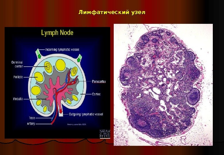   Лимфатический узел 