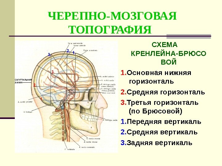 Проекция средней менингеальной артерии по схеме кренлейна брюсовой