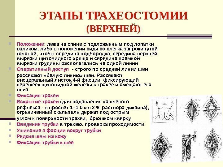 Трахеостомия топографическая анатомия и Оперативная хирургия. Трахеостомия техника выполнения операция.