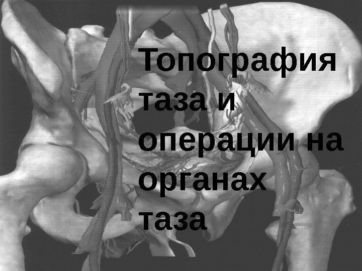   Топография таза и операции на органах таза 