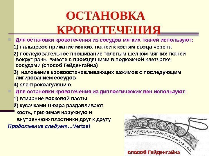    ОСТАНОВКА  КРОВОТЕЧЕНИЯ Для остановки кровотечения из сосудов мягких тканей используют: