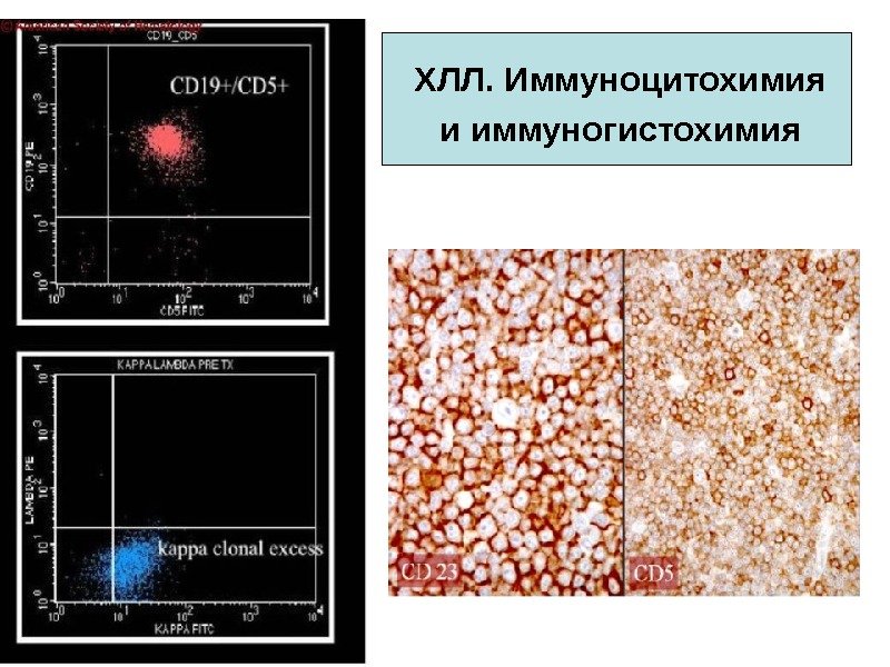 ХЛЛ. Иммуноцитохимия и иммуногистохимия 