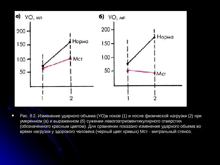  Рис. 8. 2. Изменение ударного объема (YO)в покое (1) и после физической нагрузки