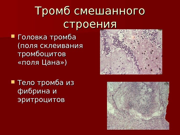 Тромбоциты и тромбы