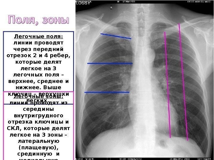 Плащевой отдел легкого на картинке