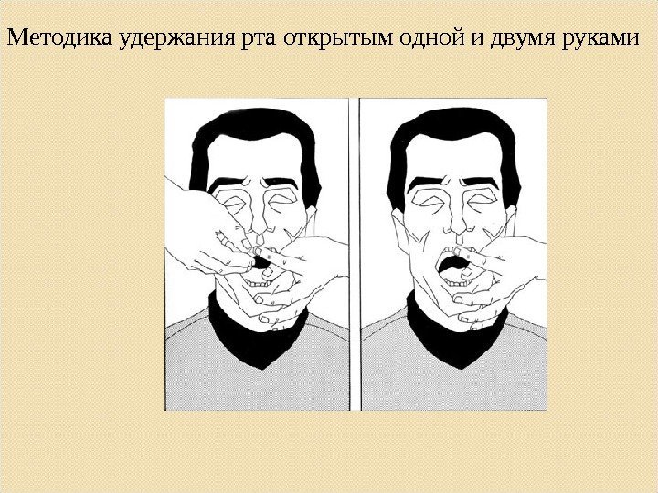 Методика удержания рта открытым одной и двумя руками 