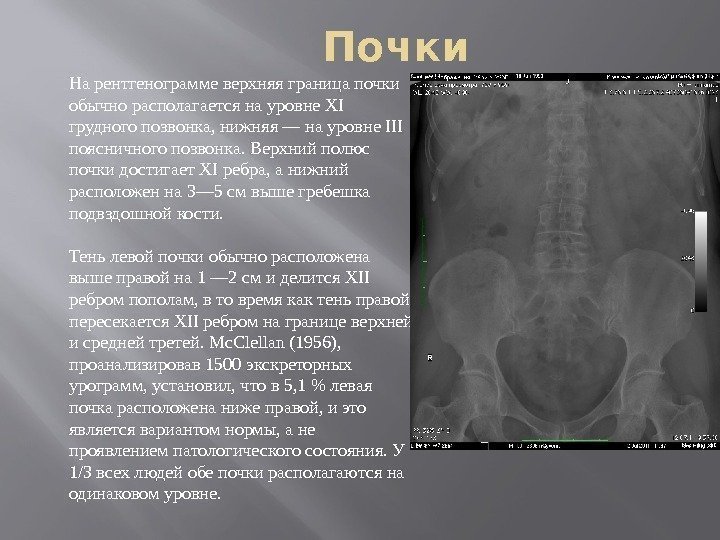 Неполное удвоение члс