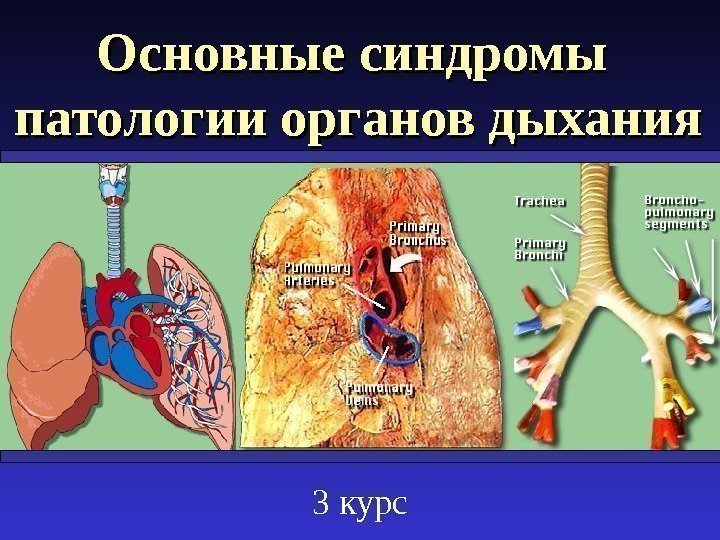 Основные синдромы патологии органов дыхания 3 курс 