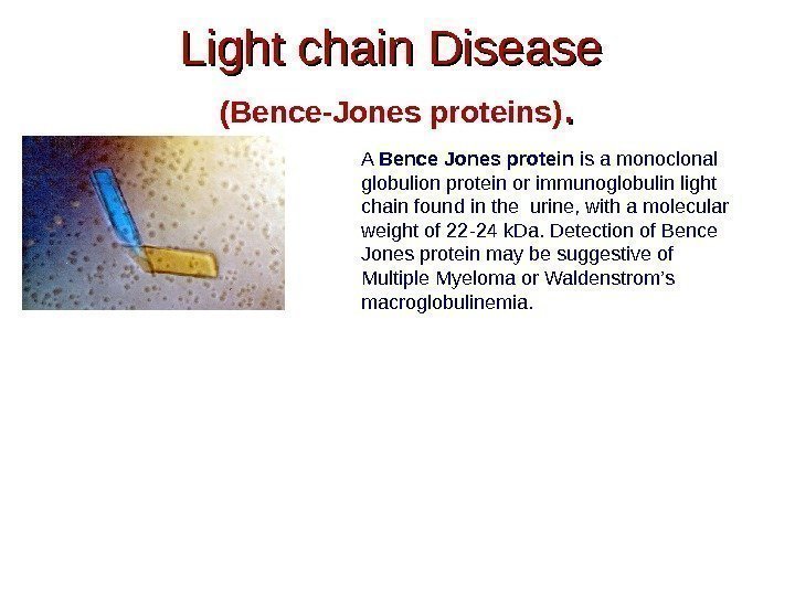 Light chain Disease (Bence-Jones proteins). . A Bence Jones protein is a monoclonal globulion