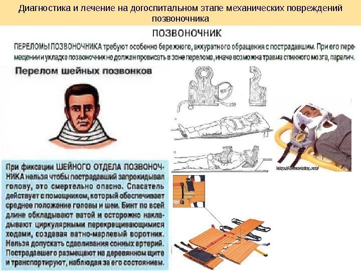 Диагностика и лечение на догоспитальном этапе механических повреждений позвоночника 