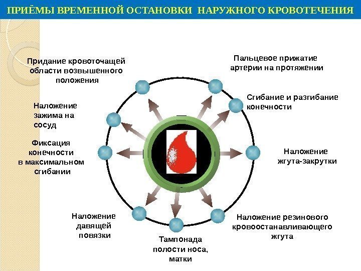 ПРИЁМЫ ВРЕМЕННОЙ ОСТАНОВКИ НАРУЖНОГО КРОВОТЕЧЕНИЯ Пальцевое прижатие артерии на протяжении. Придание кровоточащей области возвышенного