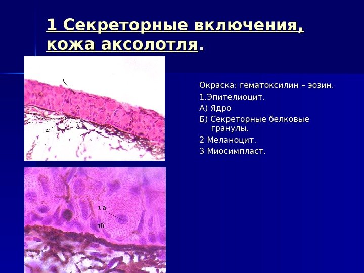 1 Секреторные включения,  кожа аксолотля. . Окраска: гематоксилин – эозин. 1. Эпителиоцит. А)