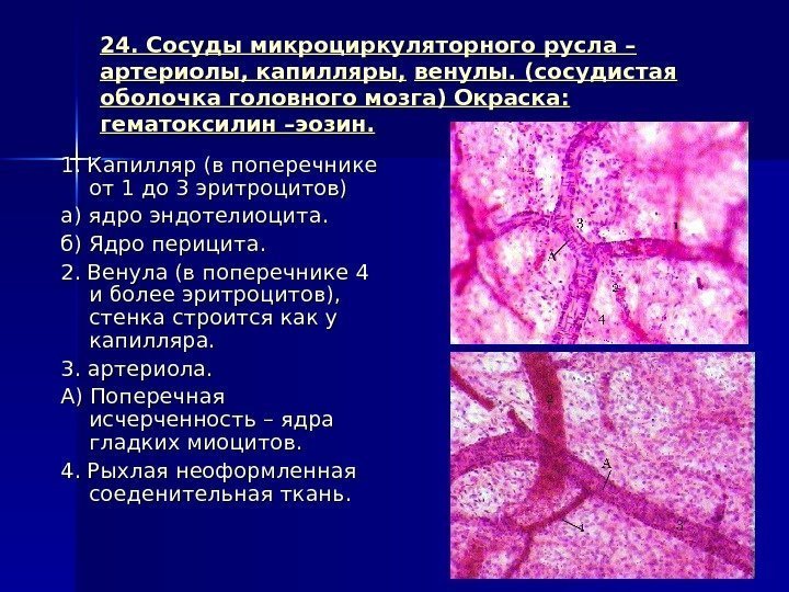 24. Сосуды микроциркуляторного русла – артериолы, капилляры, венулы. (сосудистая оболочка головного мозга) Окраска: 