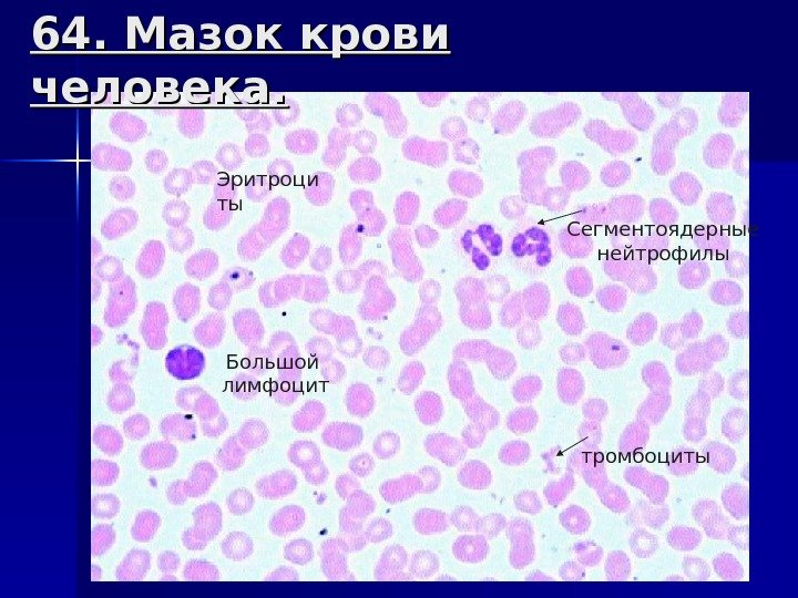 64. Мазок крови человека. Сегментоядерные нейтрофилы Большой лимфоцит тромбоциты. Эритроци ты 