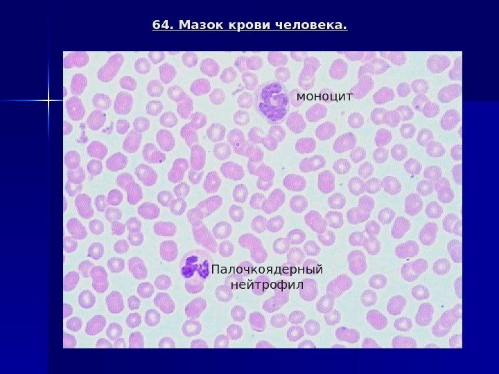64. Мазок крови человека. моноцит Палочкоядерный нейтрофил 