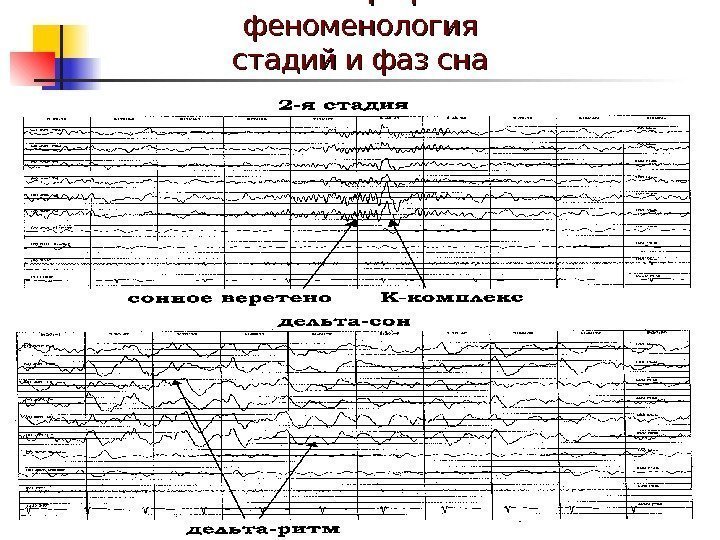  Полисомнографическая феноменология стадий и фаз сна 