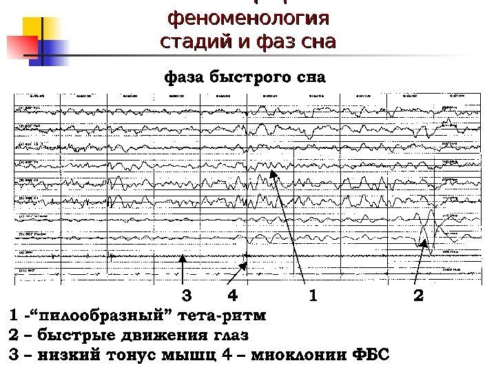  Полисомнографическая феноменология стадий и фаз сна 