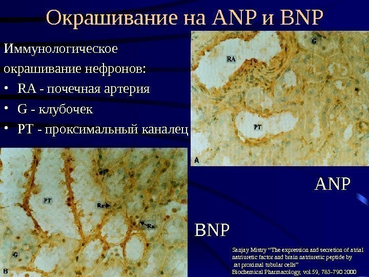   Окрашивание на ANP и BNP Иммунологическое окрашивание нефронов:  • RA -