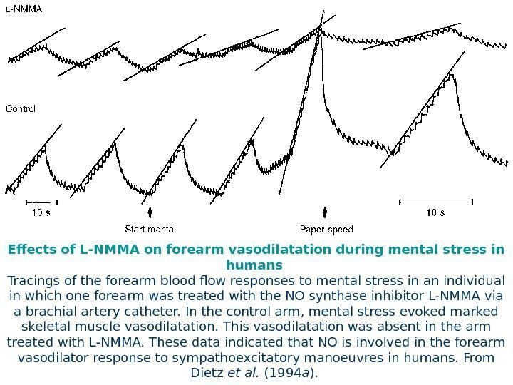   Effects of L-NMMA on forearm vasodilatation during mental stress in humans 