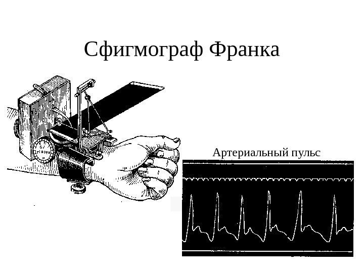   Сфигмограф Франка  Сфигмограмма артериального пульса Артериальный пульс 
