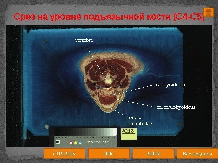 Срез на уровне подъязычной кости (C 4 -C 5) medulla spinalis ЦНС АНГИСПЛАНХ Все