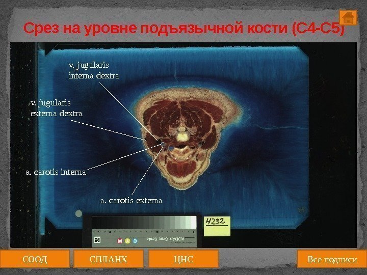 Срез на уровне подъязычной кости (C 4 -C 5) medulla spinalis СООД ЦНССПЛАНХ Все