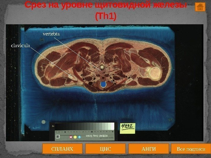 Срез на уровне щитовидной железы (Th 1) ЦНС АНГИСПЛАНХ Все подписиclavicula vertebta 